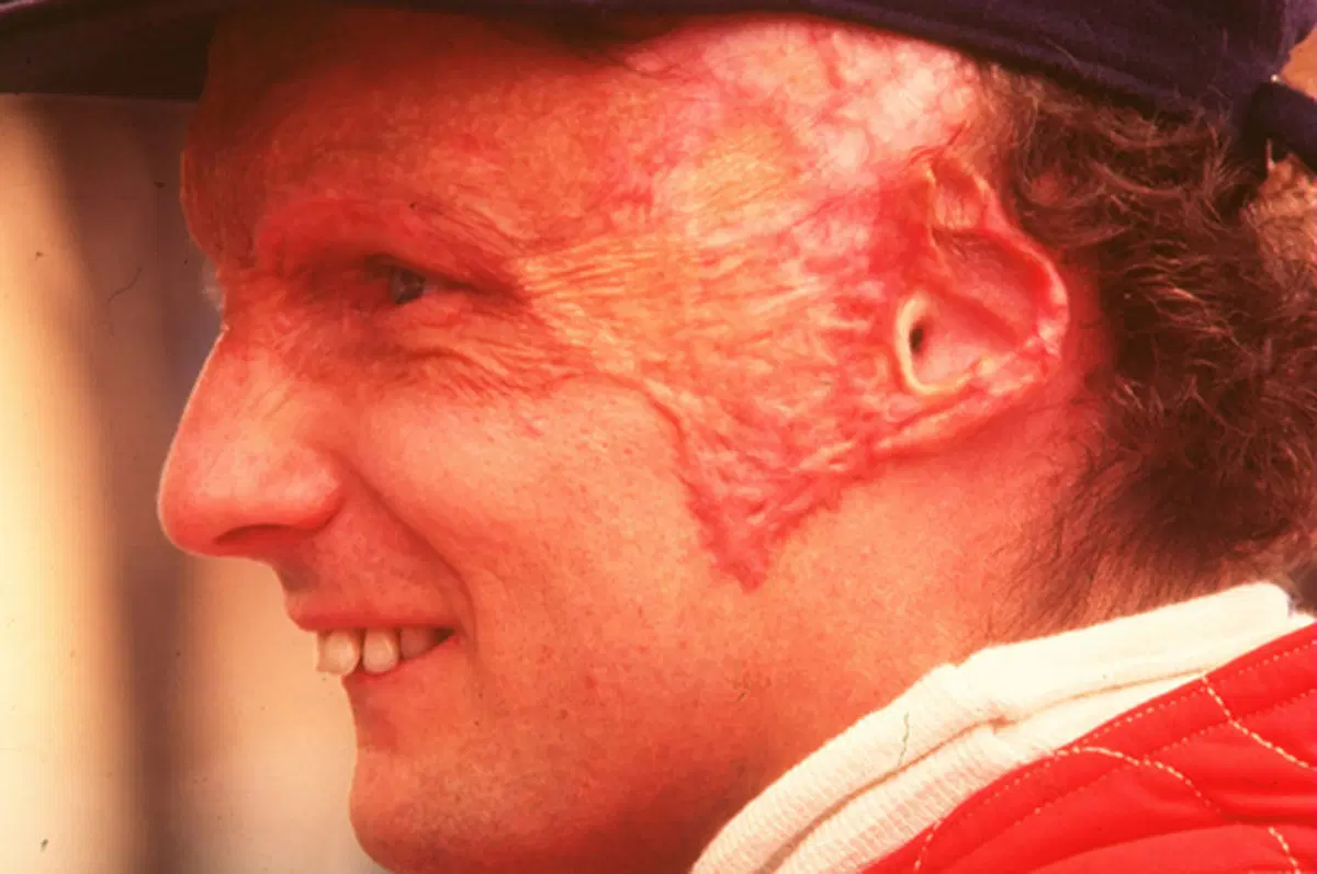 Hunt vs Lauda: il 1 agosto del 1976 avveniva il tragico incidente (12)