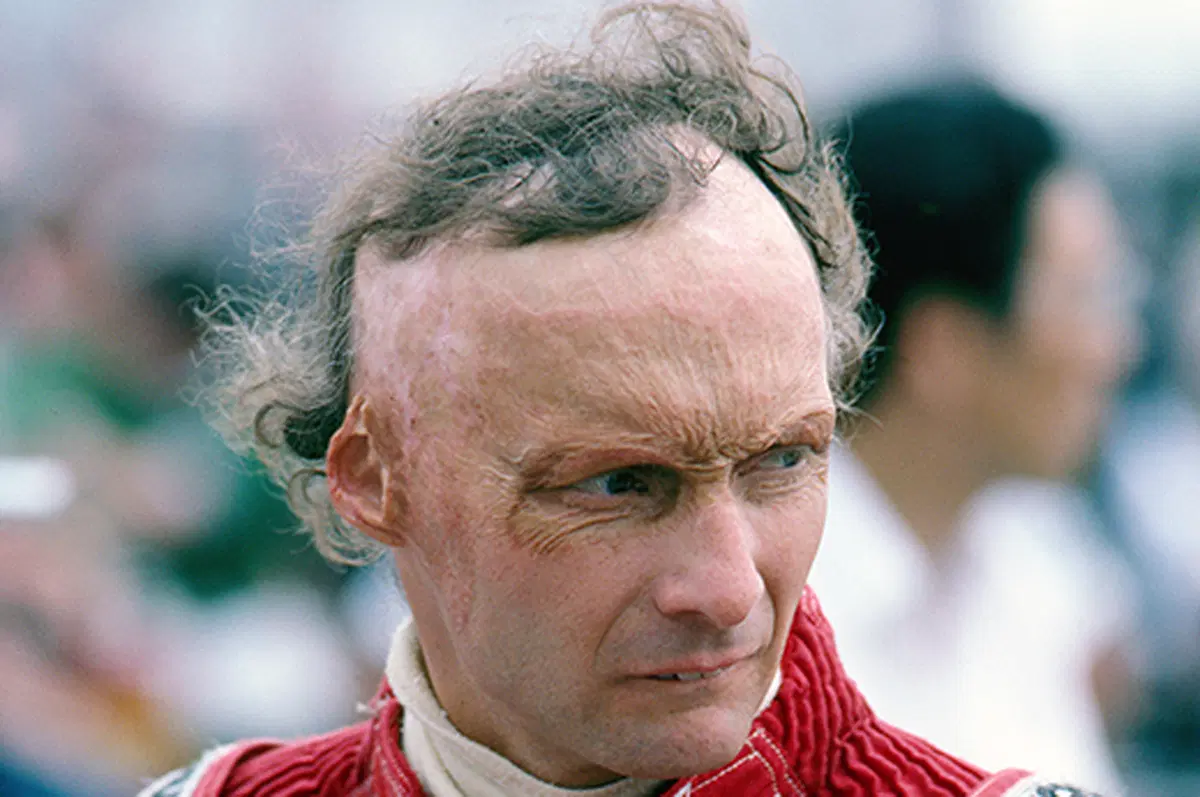 Hunt vs Lauda: il 1 agosto del 1976 avveniva il tragico incidente (13)